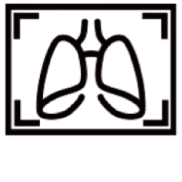 Rentgen hrudníku
